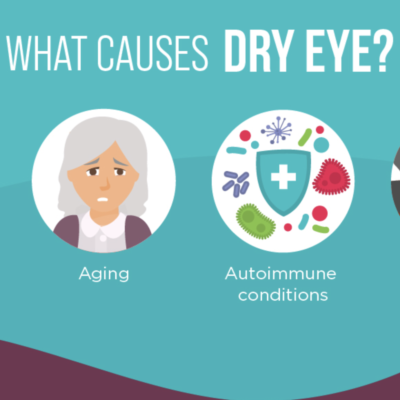 Dry Eye Social Graphics