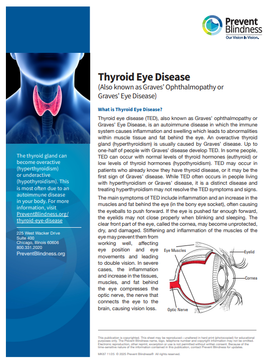 Thyroid Eye Disease